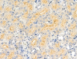 Invitrogen CABC1 Polyclonal Antibody 100 &mu;L; Unconjugated:Antibodies,