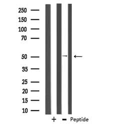 Invitrogen CABC1 Polyclonal Antibody 100 &mu;L; Unconjugated:Antibodies,