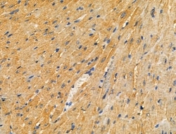 Invitrogen PARD3 Polyclonal Antibody 100 &mu;L; Unconjugated:Antibodies,