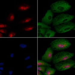 Invitrogen GTF3C2 Polyclonal Antibody 100 μL; Unconjugated:Antibodies,