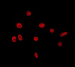 Invitrogen TAF15 Polyclonal Antibody 100 &mu;L; Unconjugated:Antibodies,