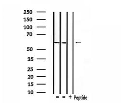 Invitrogen TAF15 Polyclonal Antibody 100 &mu;L; Unconjugated:Antibodies,