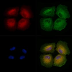 Invitrogen SLC22A18 Polyclonal Antibody 100 &mu;L; Unconjugated:Antibodies,