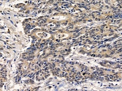 Invitrogen SLC22A18 Polyclonal Antibody 100 &mu;L; Unconjugated:Antibodies,