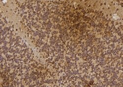 Invitrogen IP6K3 Polyclonal Antibody 100 &mu;L; Unconjugated:Antibodies,
