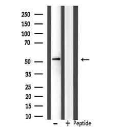 Invitrogen IP6K3 Polyclonal Antibody 100 &mu;L; Unconjugated:Antibodies,