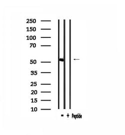 Invitrogen IP6K3 Polyclonal Antibody 100 &mu;L; Unconjugated:Antibodies,