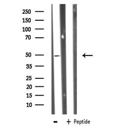Invitrogen ZNF436 Polyclonal Antibody 100 &mu;L; Unconjugated:Antibodies,