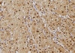 Invitrogen ILKAP Polyclonal Antibody 100 &mu;L; Unconjugated:Antibodies,