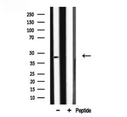 Invitrogen ILKAP Polyclonal Antibody 100 &mu;L; Unconjugated:Antibodies,