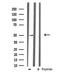 Invitrogen AZI2 Polyclonal Antibody 100 &mu;L | Buy Online | Invitrogen&trade; | Fisher Scientific