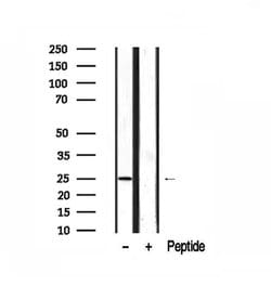 Invitrogen AKIP1 Polyclonal Antibody 100 &mu;L; Unconjugated:Antibodies,