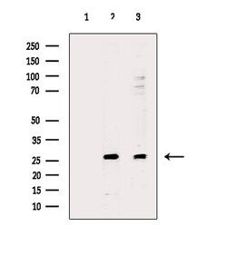Invitrogen AKIP1 Polyclonal Antibody 100 &mu;L; Unconjugated:Antibodies,