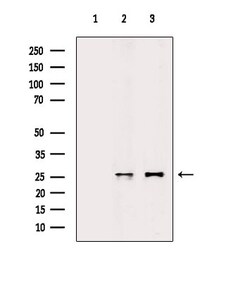 Invitrogen AKIP1 Polyclonal Antibody 100 &mu;L; Unconjugated:Antibodies,