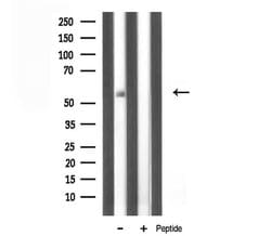 Invitrogen TBX22 Polyclonal Antibody 100 μL; Unconjugated:Antibodies,