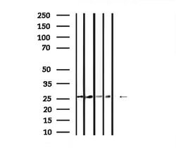 Invitrogen 14-3-3 gamma Polyclonal Antibody 100 μL; Unconjugated:Antibodies,