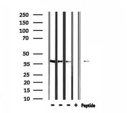 Invitrogen HTR1F Polyclonal Antibody 100 &mu;L; Unconjugated:Antibodies,