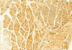 Invitrogen gamma Adducin Polyclonal Antibody 100 &mu;L; Unconjugated:Antibodies,