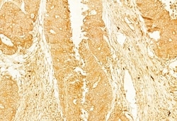 Invitrogen gamma Adducin Polyclonal Antibody 100 &mu;L; Unconjugated:Antibodies,