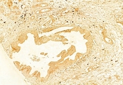 Invitrogen gamma Adducin Polyclonal Antibody 100 &mu;L; Unconjugated:Antibodies,