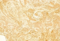 Invitrogen gamma Adducin Polyclonal Antibody 100 &mu;L; Unconjugated:Antibodies,