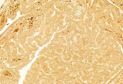 Invitrogen gamma Adducin Polyclonal Antibody 100 &mu;L; Unconjugated:Antibodies,