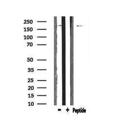 Invitrogen BCOR Polyclonal Antibody 100 &mu;L; Unconjugated:Antibodies,