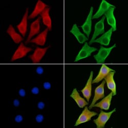 HCCS Polyclonal Antibody:Antibodies, Polyclonal