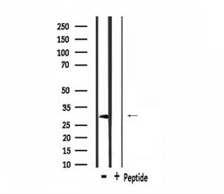 HCCS Polyclonal Antibody:Antibodies, Polyclonal