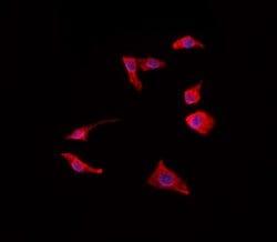 Invitrogen CCR11 Polyclonal Antibody 100 &mu;L; Unconjugated:Antibodies,