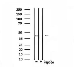 Invitrogen CCR11 Polyclonal Antibody 100 &mu;L; Unconjugated:Antibodies,