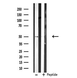 Invitrogen Cdc20 Polyclonal Antibody 100 &mu;L | Buy Online | Invitrogen&trade; | Fisher Scientific