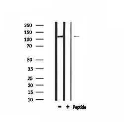 Invitrogen COL1A2 Polyclonal Antibody 100 μL; Unconjugated:Antibodies,
