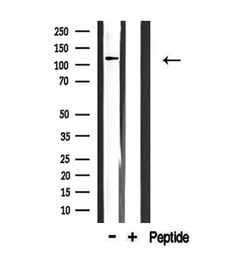 Invitrogen COL1A2 Polyclonal Antibody 100 μL; Unconjugated:Antibodies,