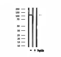 Invitrogen COL6A2 Polyclonal Antibody 100 &mu;L; Unconjugated:Antibodies,