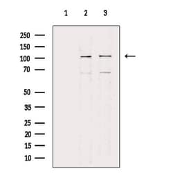 Invitrogen COL6A2 Polyclonal Antibody 100 &mu;L; Unconjugated:Antibodies,