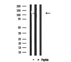 Invitrogen COL6A2 Polyclonal Antibody 100 &mu;L; Unconjugated:Antibodies,