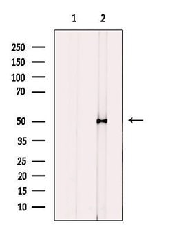 Invitrogen CYP2J2 Polyclonal Antibody 100 &mu;L; Unconjugated:Antibodies,