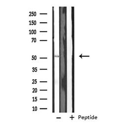 Invitrogen CYP2J2 Polyclonal Antibody 100 &mu;L; Unconjugated:Antibodies,