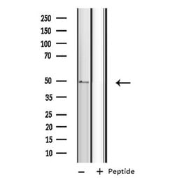 Invitrogen CYP4B1 Polyclonal Antibody 100 &mu;L; Unconjugated:Antibodies,