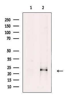 FGF18 Polyclonal Antibody:Antibodies, Polyclonal
