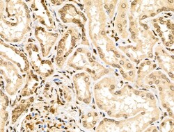 Invitrogen MLH3 Polyclonal Antibody 100 &mu;L; Unconjugated:Antibodies,
