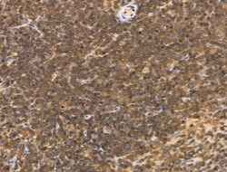 Invitrogen MLH3 Polyclonal Antibody 100 &mu;L; Unconjugated:Antibodies,