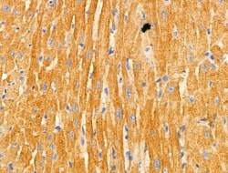 Invitrogen TRAF3IP3 Polyclonal Antibody 100 &mu;L | Buy Online | Invitrogen&trade; | Fisher Scientific