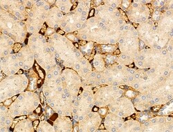 Invitrogen TRAF3IP3 Polyclonal Antibody 100 &mu;L | Buy Online | Invitrogen&trade; | Fisher Scientific