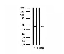 Invitrogen AGPAT5 Polyclonal Antibody 100 &mu;L; Unconjugated:Antibodies,