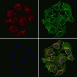 Invitrogen MRPL10 Polyclonal Antibody 100 &mu;L; Unconjugated:Antibodies,