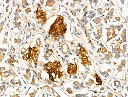 Invitrogen MRPL10 Polyclonal Antibody 100 &mu;L; Unconjugated:Antibodies,
