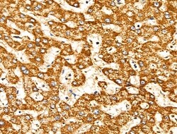 Invitrogen MRPL10 Polyclonal Antibody 100 &mu;L; Unconjugated:Antibodies,