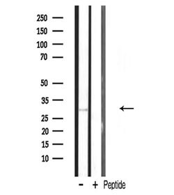 Invitrogen MRPL10 Polyclonal Antibody 100 &mu;L; Unconjugated:Antibodies,